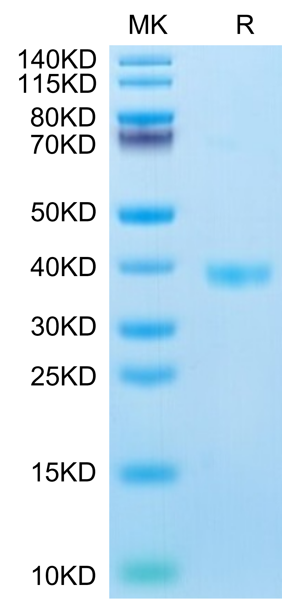 Mouse JAM-A Protein (JAM-MM10A)