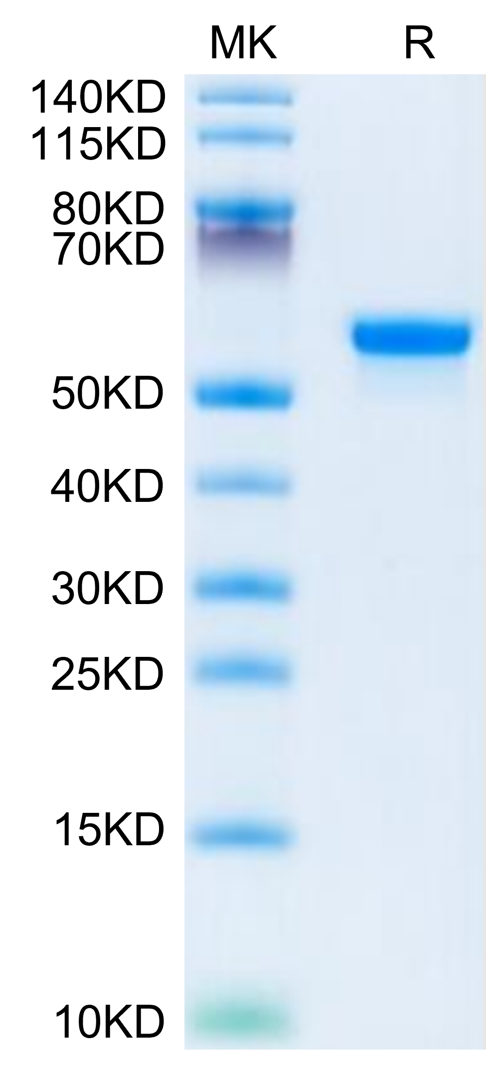 Human LGMN Protein (LGM-HM101)