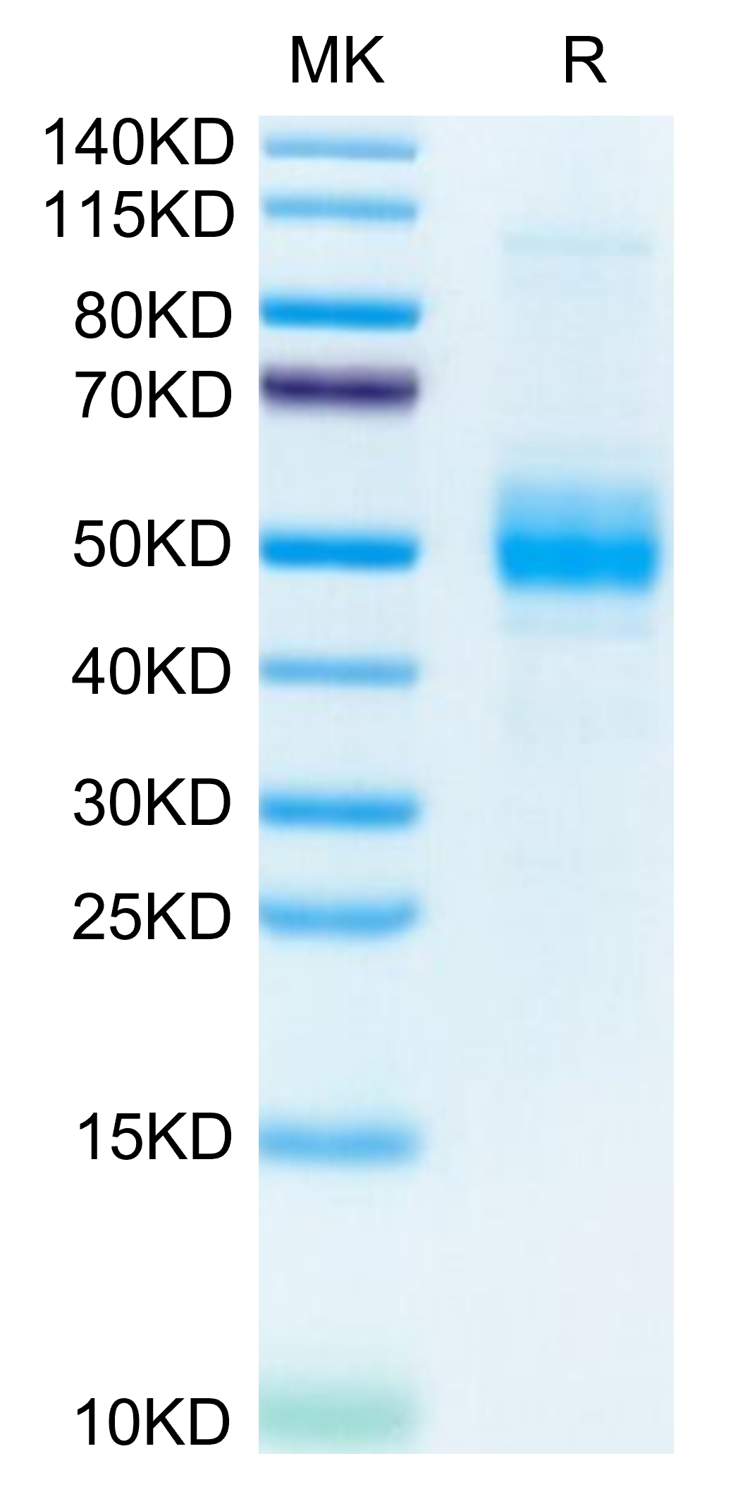 Mouse Kremen-2 Protein (KRE-MM102)