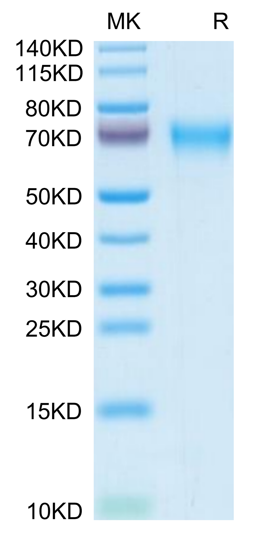 Mouse LCAT Protein (LAT-MM101)