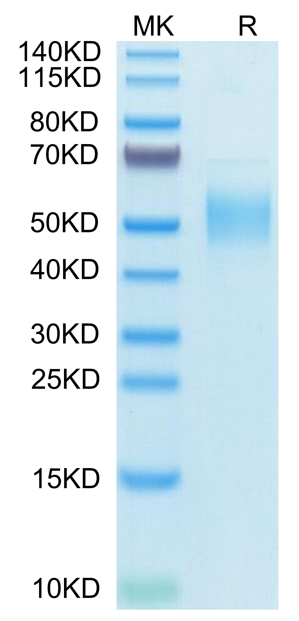 Human PLA2G7 Protein (PLA-HM107) – KACTUS