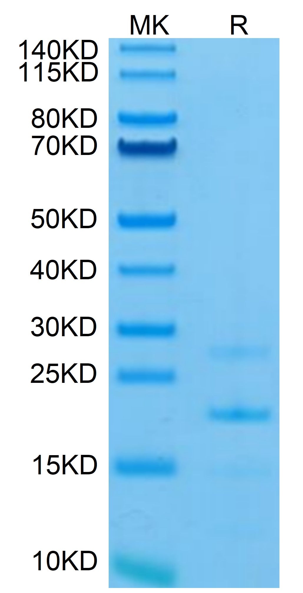 Mouse MASP2 Protein (MSP-ME102)