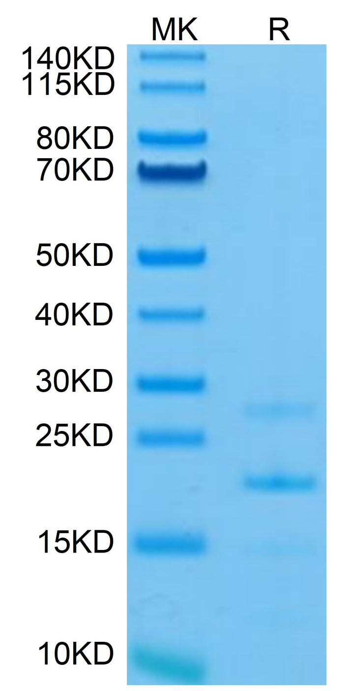 Mouse MASP2 Protein (MSP-ME102)