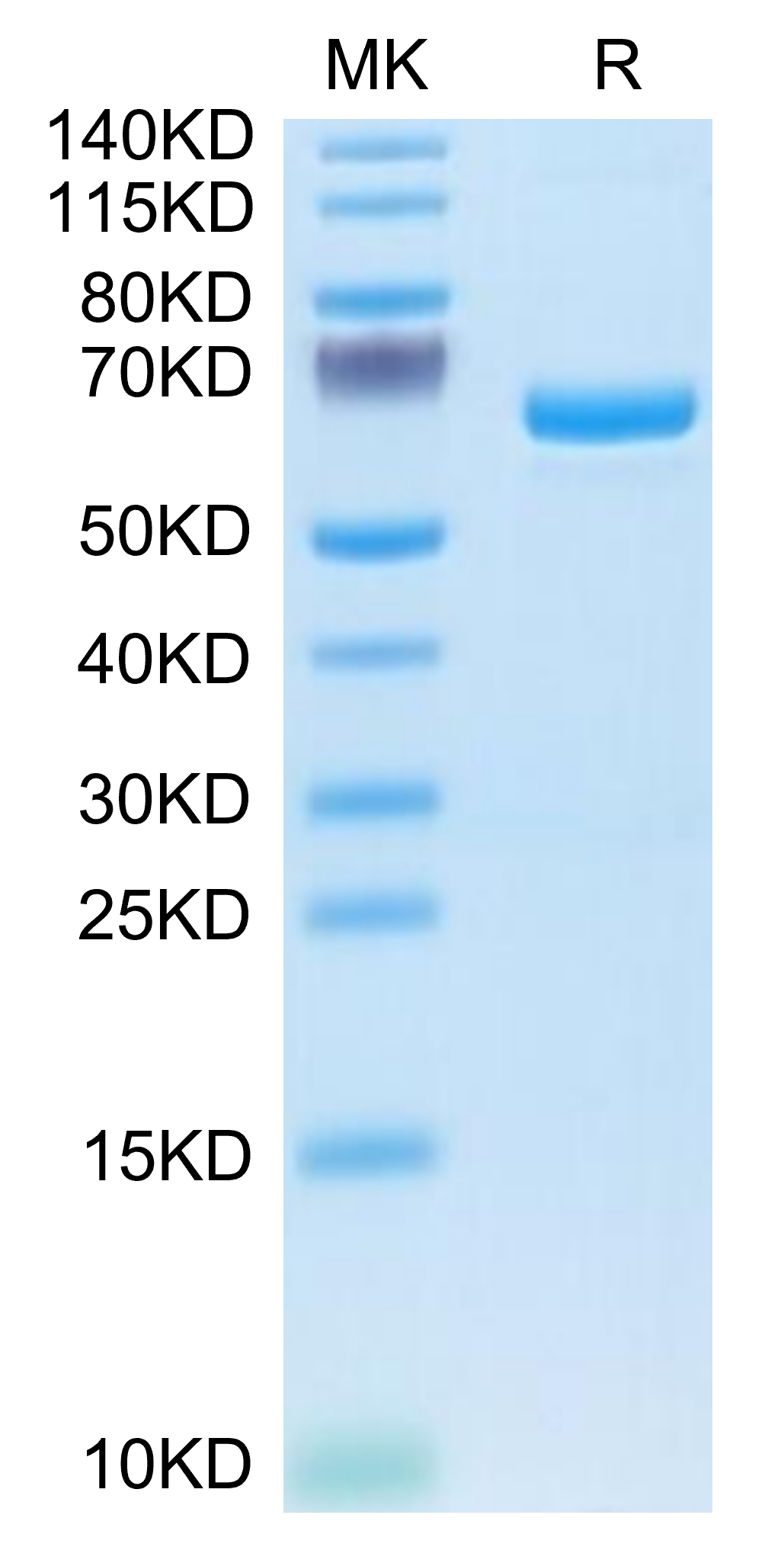 Human APOE4/Apolipoprotein E Protein (APO-HM202)