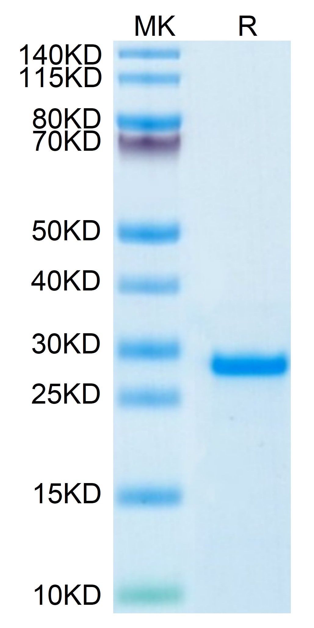 Human PS20 Protein (PS2-HE120) | KACTUS