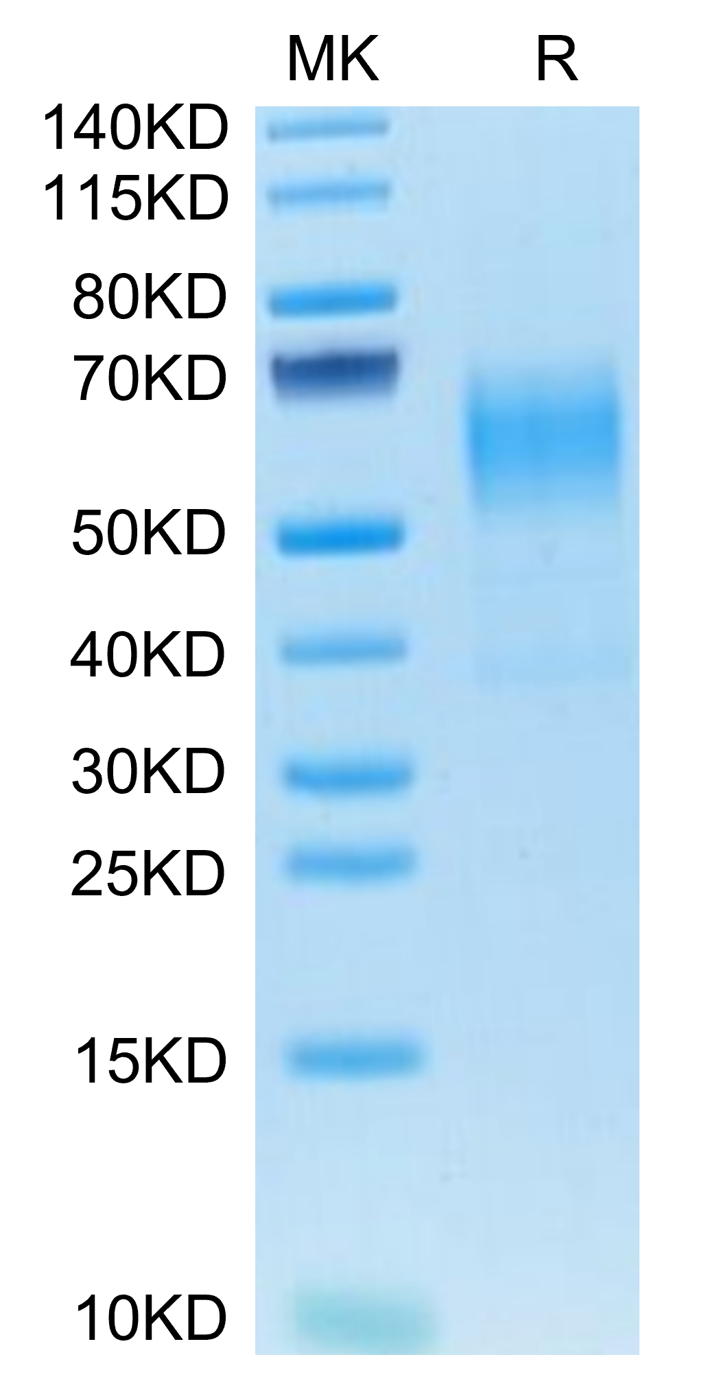 Mouse CD19 Protein (CD1-MM119)