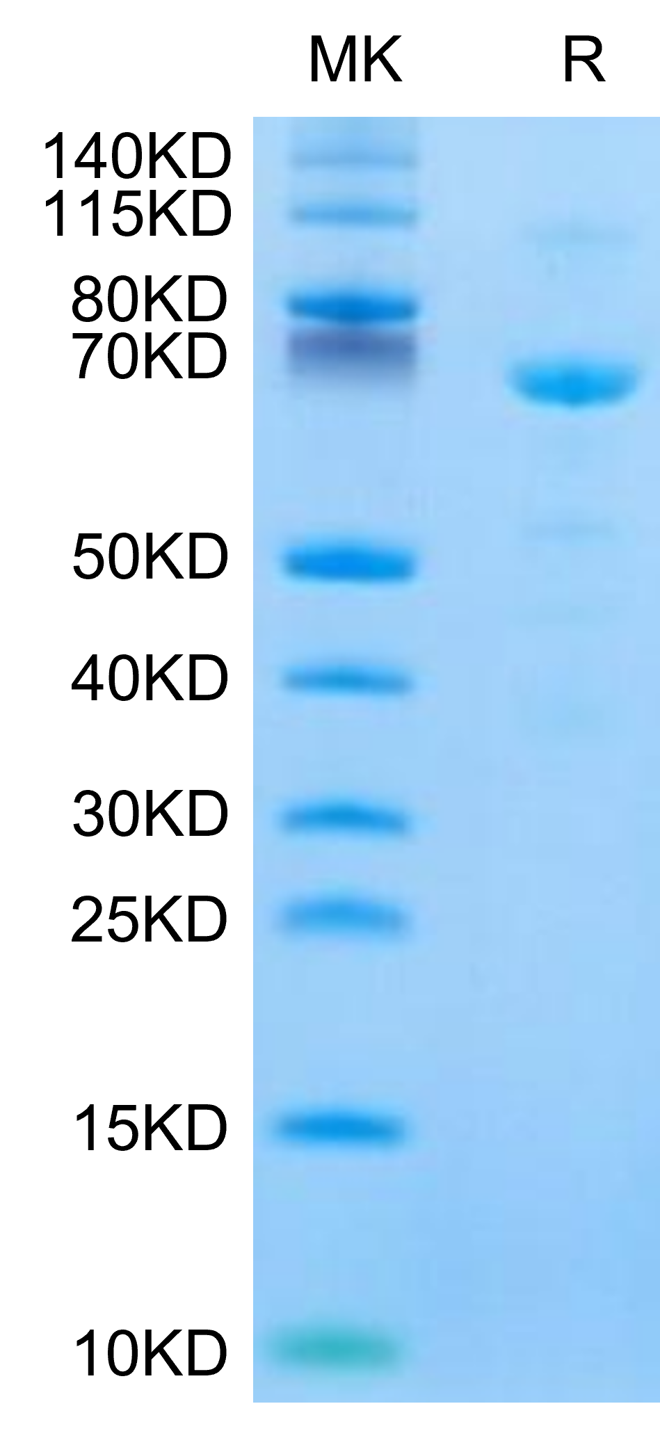 Human CDH11/Cadherin 11 Protein (CDH-HM111)