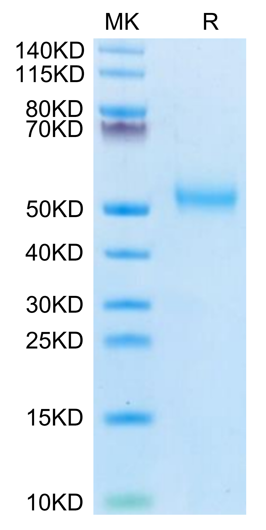 Human FcRH6/FCRL6 Protein (FCR-HM106)