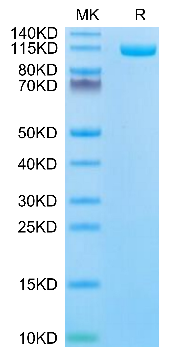 Biotinylated Human ENPP-1 Protein (ENP-HM402B)