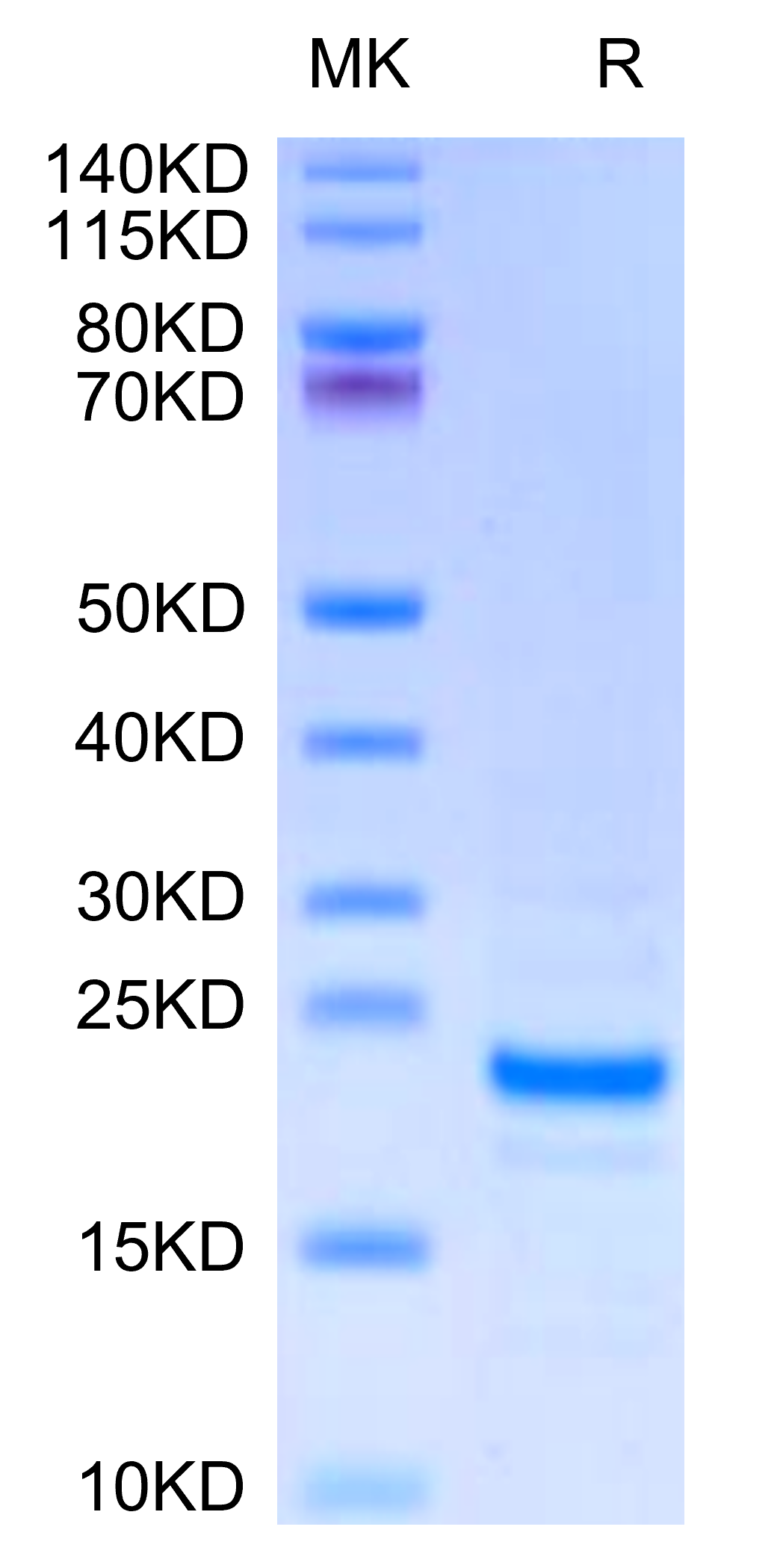 Mouse Midkine Protein (MID-ME101)