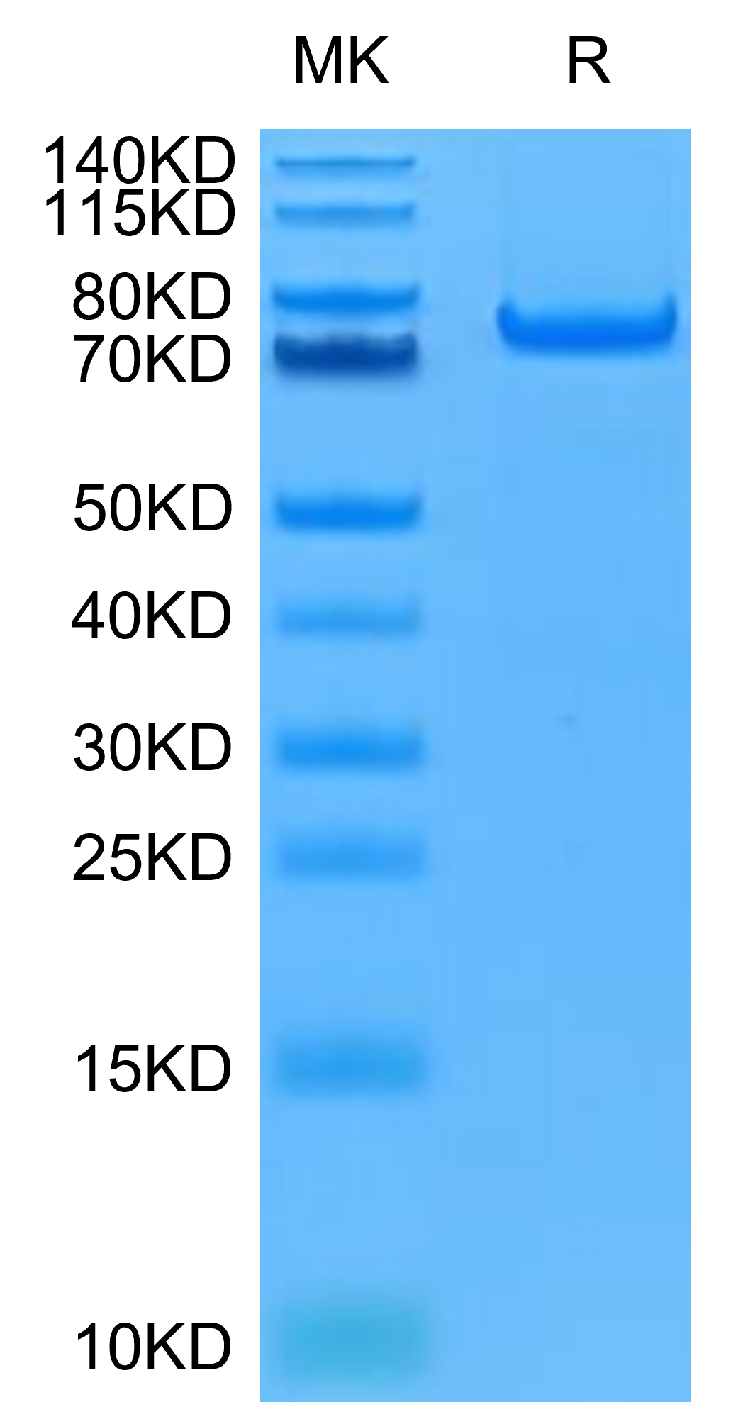 Human PADI4 Protein (PAD-HE104)