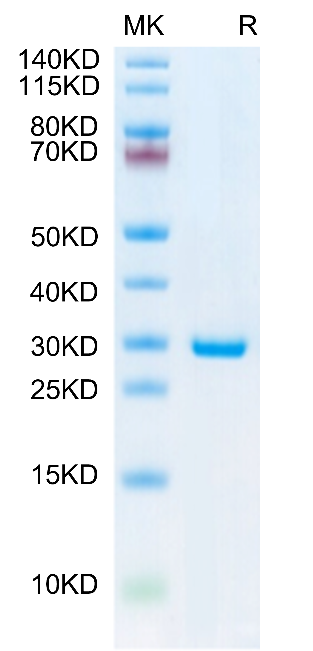 SDS-PAGE image showing purified protein band with molecular weight marker for validation of sample quality and expression level.