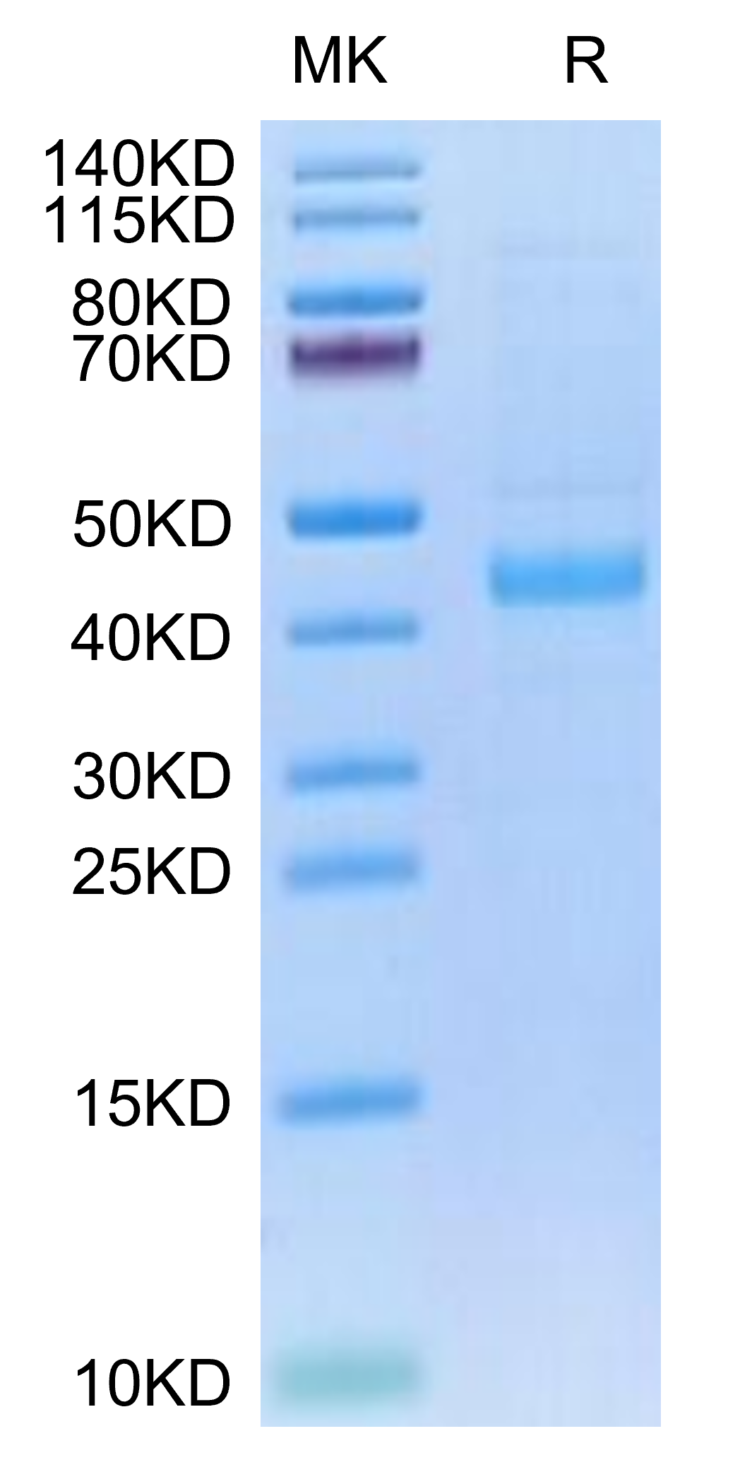 Human SFRP1/SARP2 Protein (SFP-HM101) – KACTUS