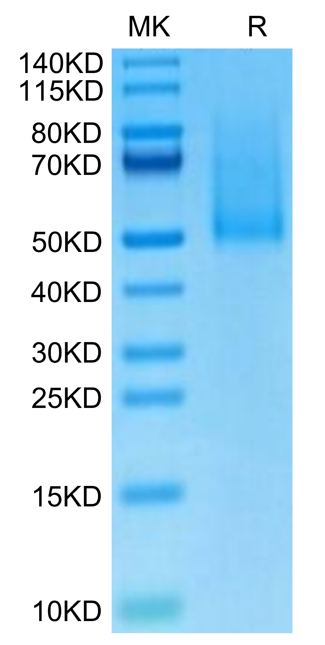 Cynomolgus CX3CL1/Fractalkine Protein (CX3-CM101)