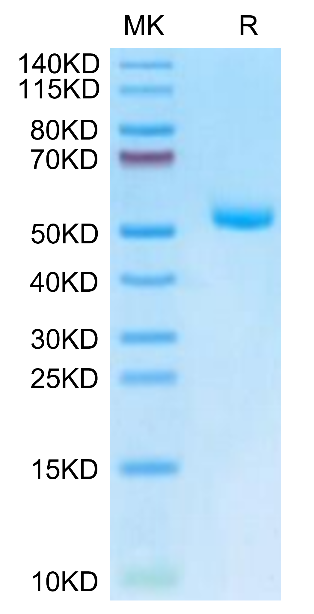 Mouse EVA-1/MPZL2 Protein (EVA-MM201)