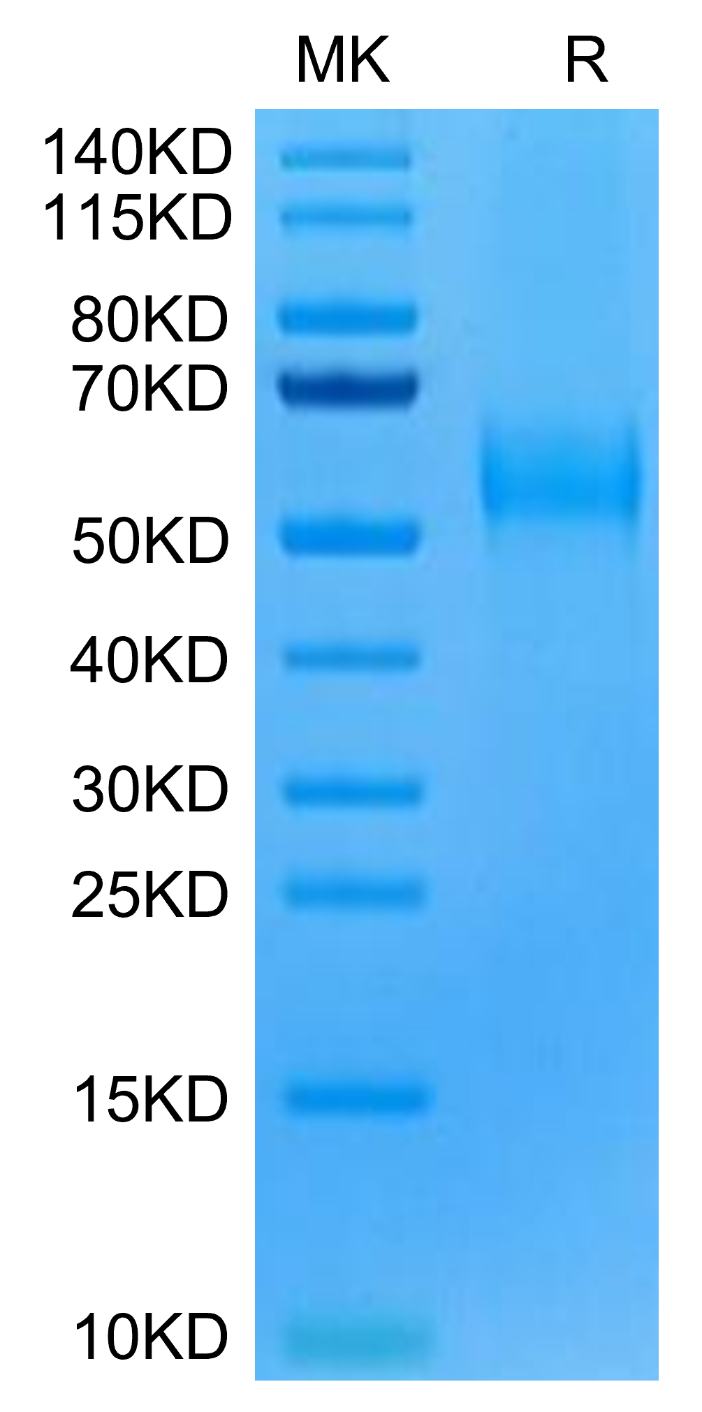 Human CDH17/Cadherin 17 Domain 5-7 Protein (CDH-HM1D4)