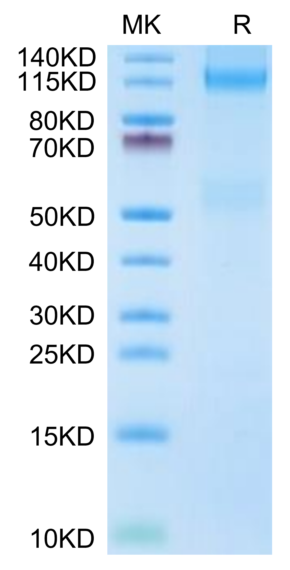 Mouse IGF1R/CD221 Protein (IGF-MM41R)