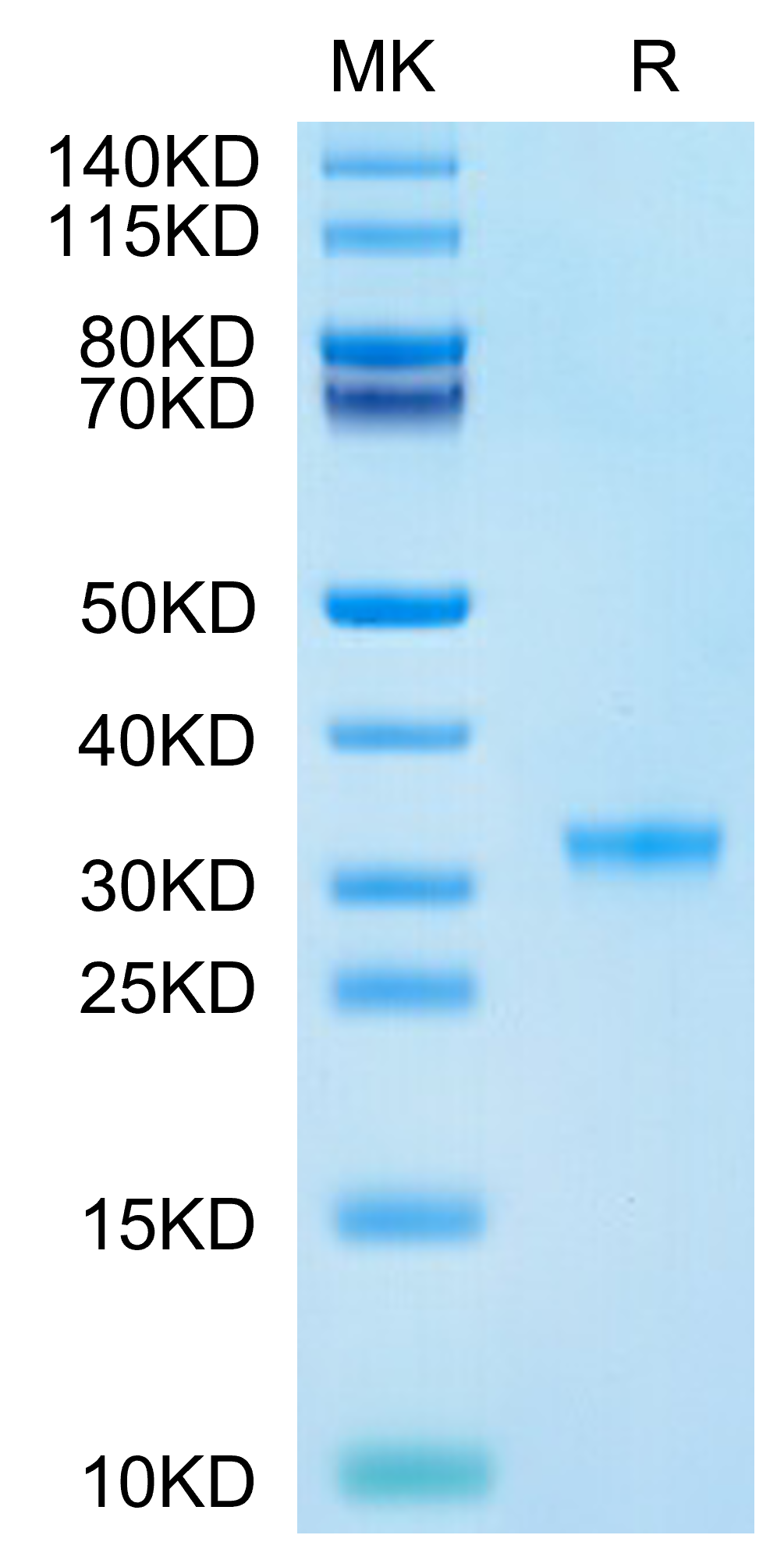 SARS-CoV-2 3CLpro/3C-like Protease Protein (P132H)  (COV-VE0LE)