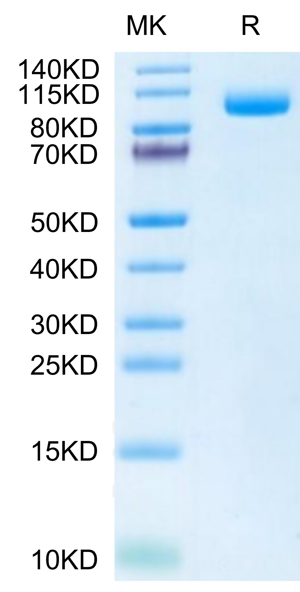 Biotinylated Mouse PSMA/FOLH1 Protein (Primary Amine Labeling) (PSM-MM ...