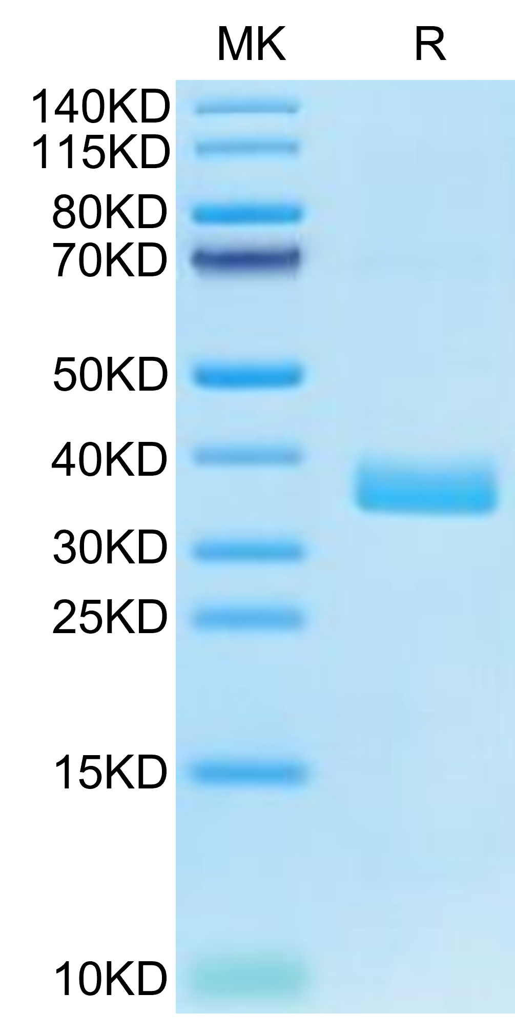 Human APOE4/Apolipoprotein E Protein (APO-HM102)