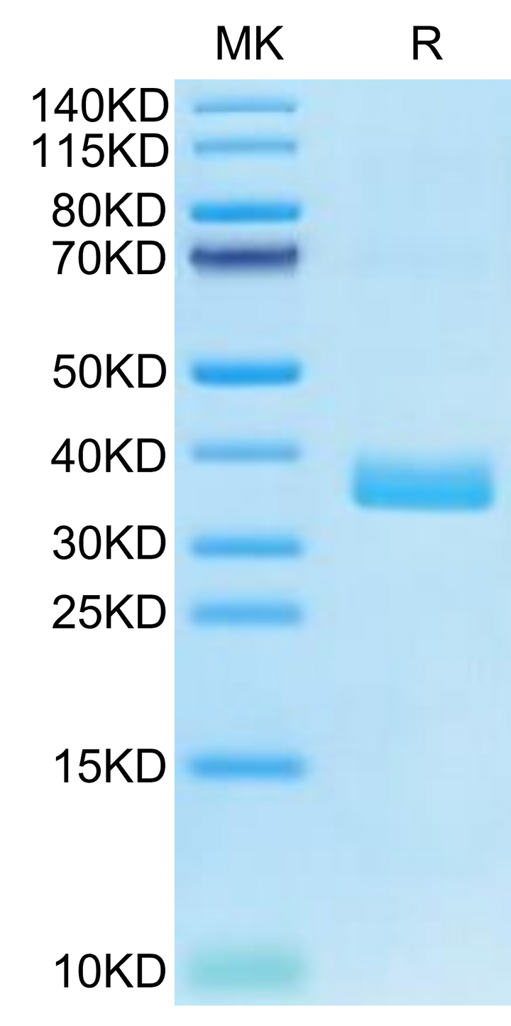 Human APOE4/Apolipoprotein E Protein (APO-HM102)