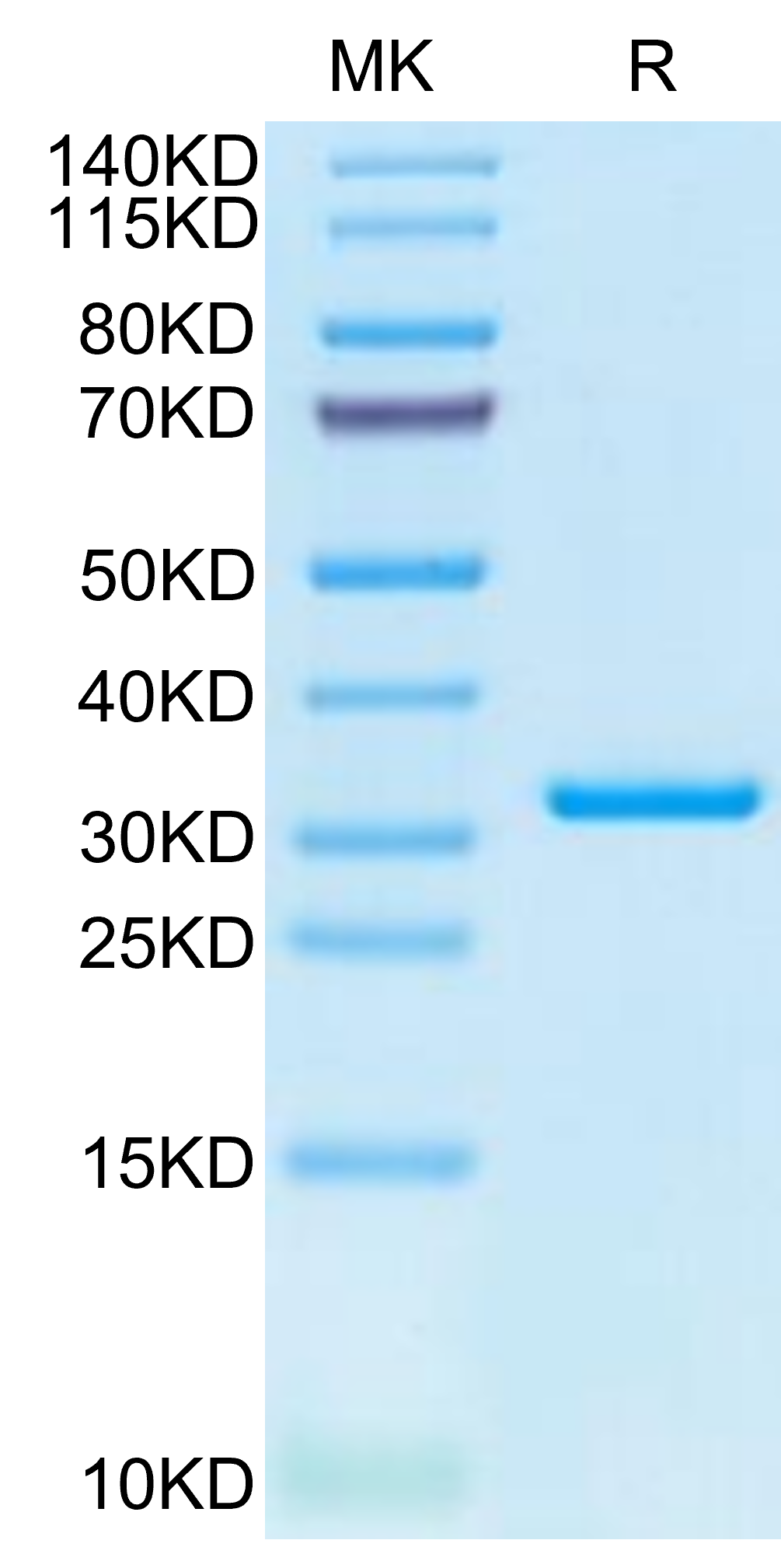 SARS-CoV-2 3CLpro/3C-like Protease Protein (L50F, E166V)  (COV-VE0LL)