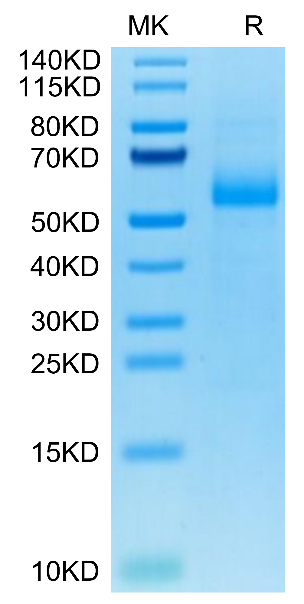 Cynomolgus AGER Protein (AER-CM101)