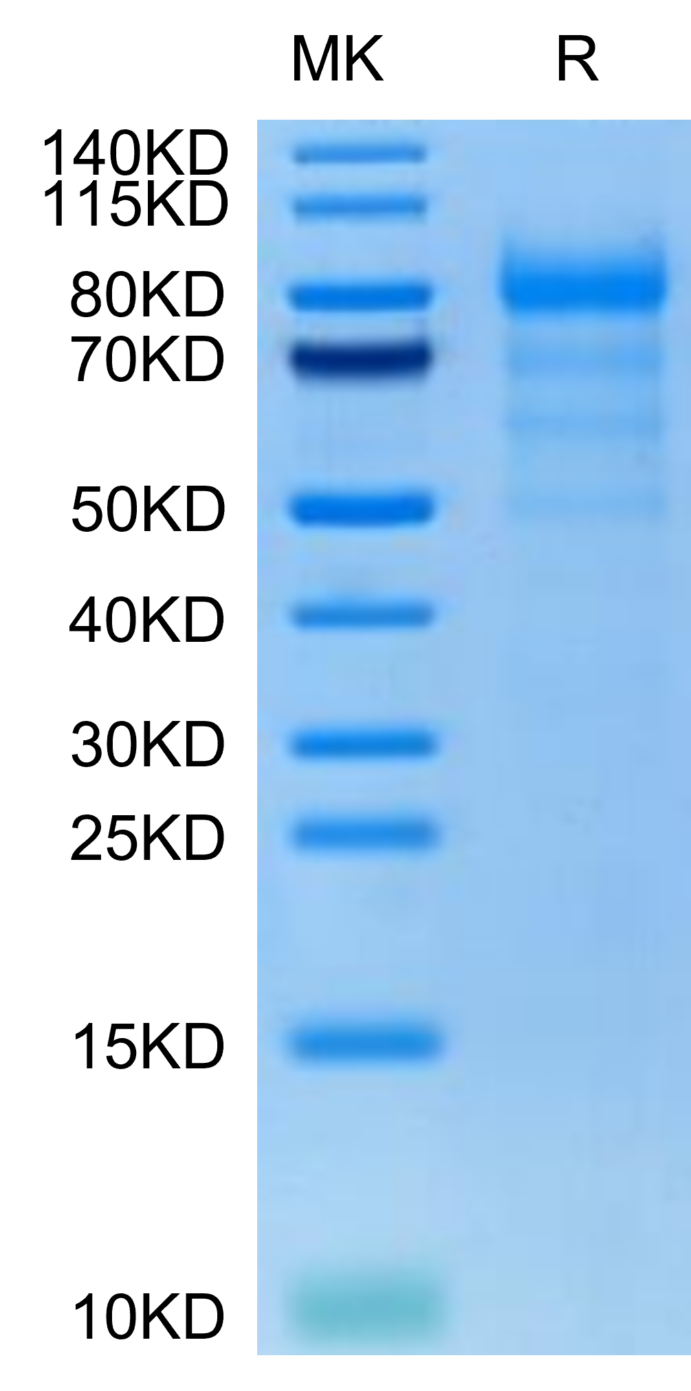 Human CDH6/Cadherin-6 Protein (CDH-HM116)