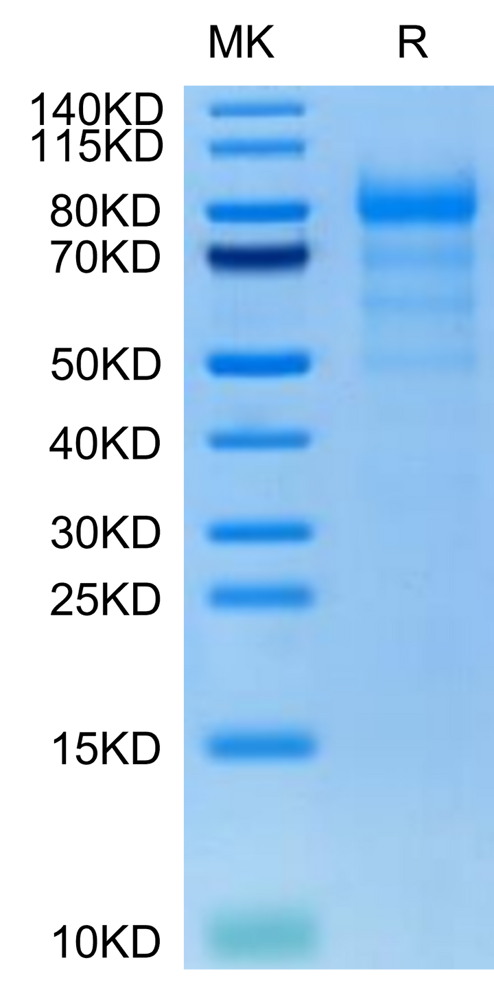 Human CDH6/Cadherin-6 Protein (CDH-HM116)