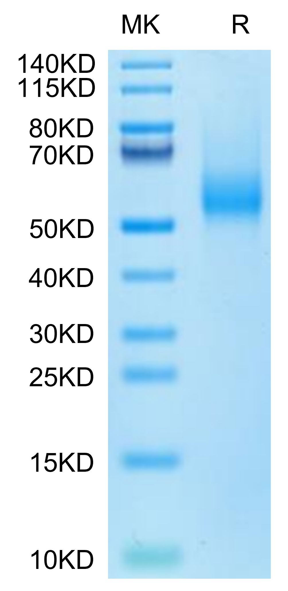 Biotinylated Human CDH17/Cadherin 17 Domain 5-7 Protein (Primary Amine Labeling)  (CDH-HM1D4B)