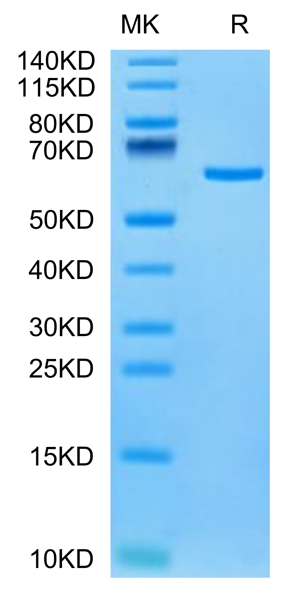 Human Tulp1 Protein (TUP-HE101)