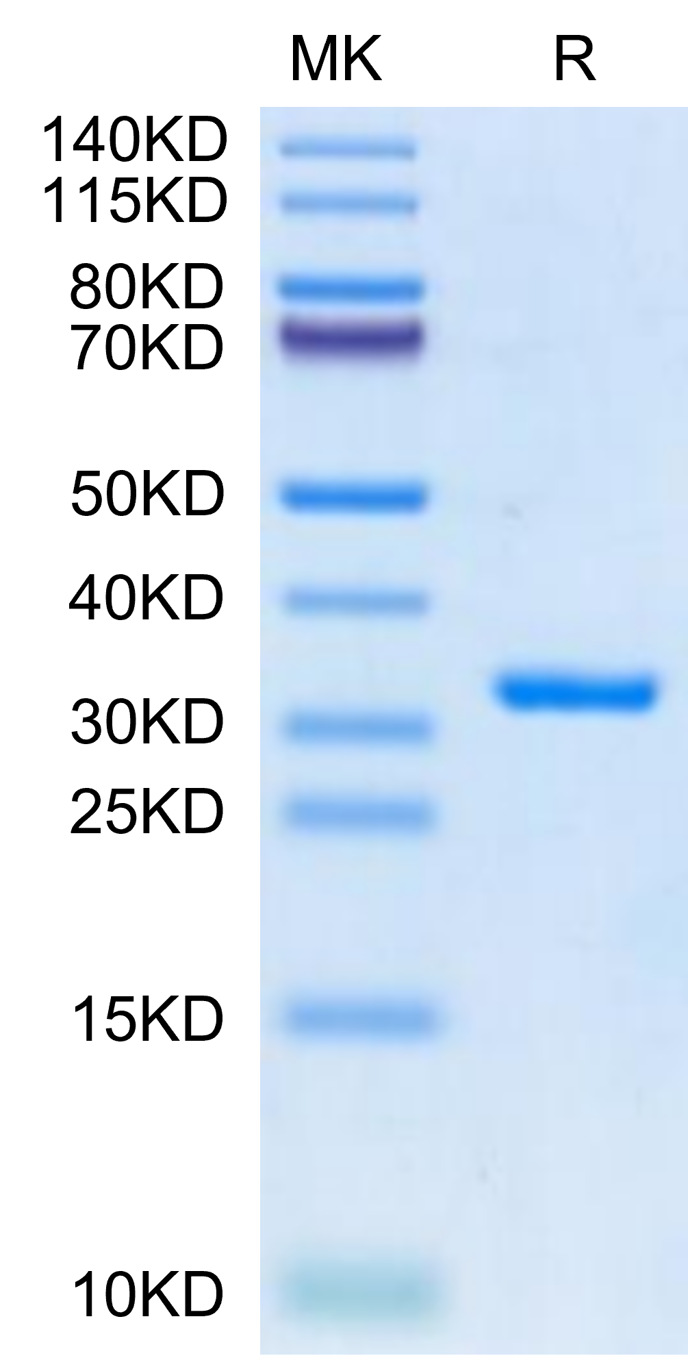 SARS-CoV-2 3CLpro/3C-like Protease Protein (E166V)  (COV-VE0LK)