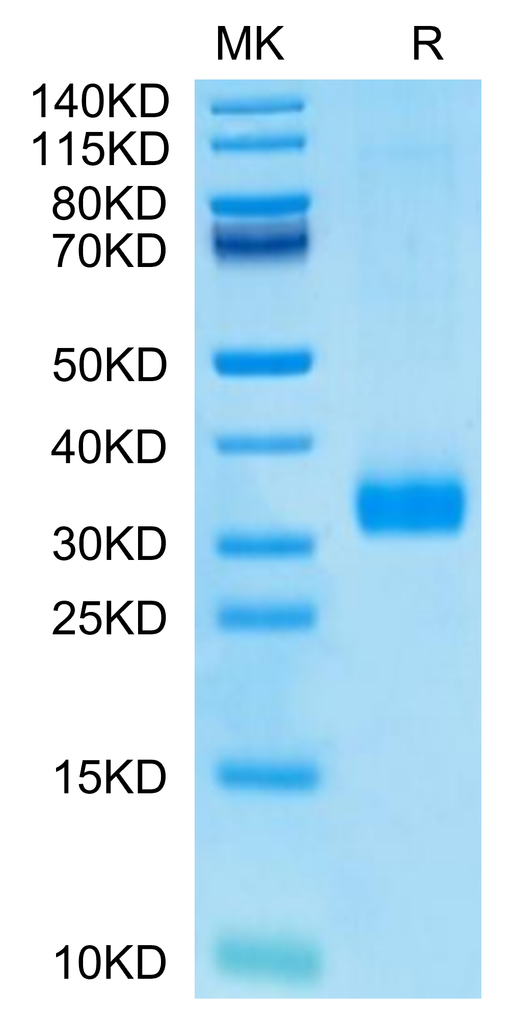 Human MBL2/Mannan Binding Lectin Protein (MBL-HM102)