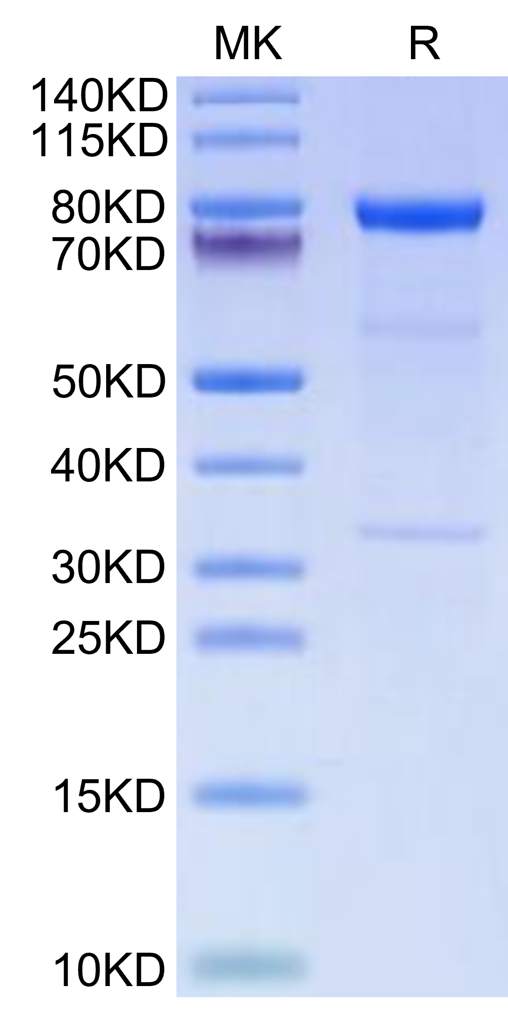 Human Complement C1s Protein (C1S-HM101)