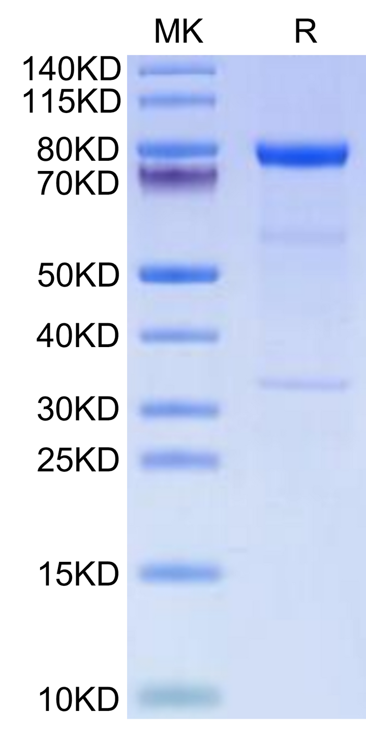 Human Complement C1s Protein (C1S-HM101)