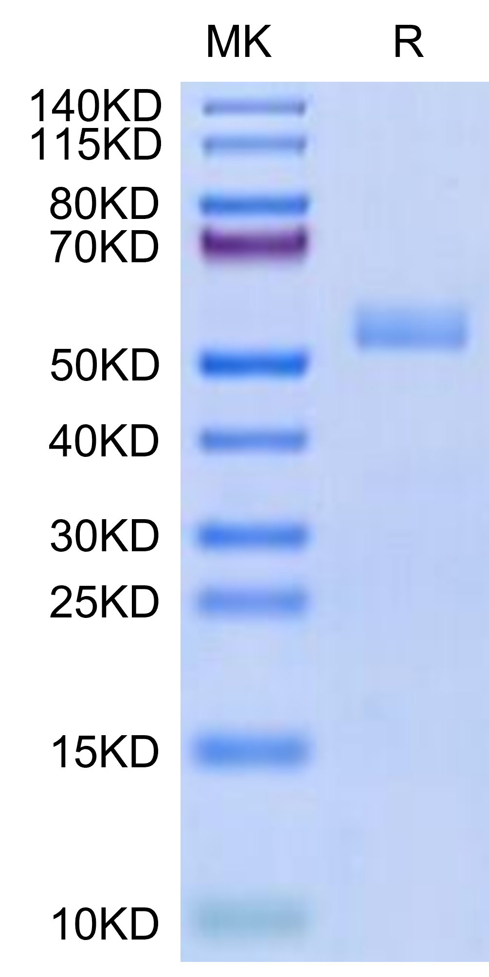 Biotinylated Mouse CD5 Protein (Primary Amine Labeling)  (CD5-MM101B)