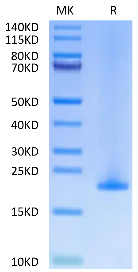 Human MD2 Protein (MD2-HE102)