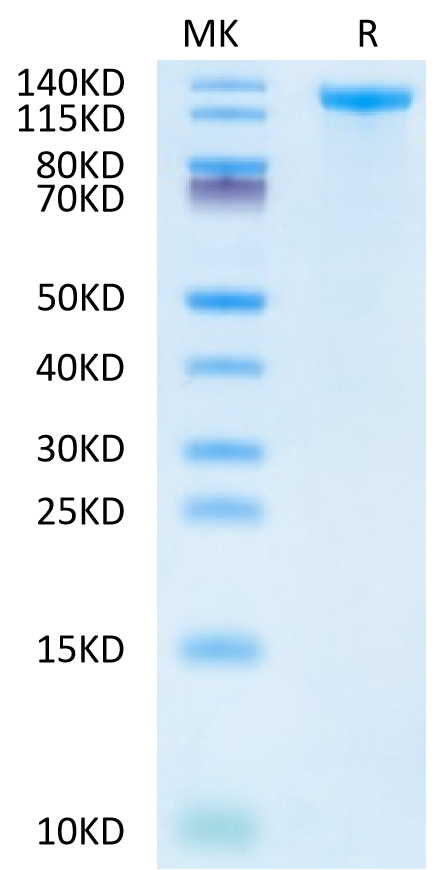 Human Jagged 1/JAG1 Protein (JAG-HM101)