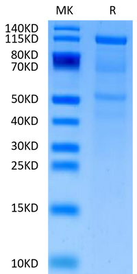 SDS-PAGE gel showing a molecular weight marker lane on the left and a single prominent protein band in the sample lane on the right, indicating high purity of the expressed protein.