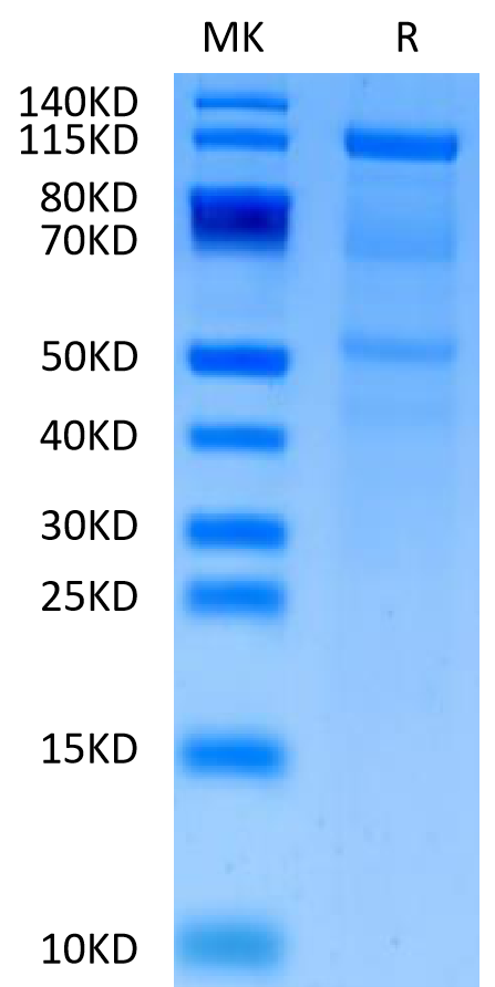 SDS-PAGE gel showing a molecular weight marker lane on the left and a single prominent protein band in the sample lane on the right, indicating high purity of the expressed protein.