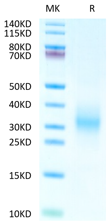 Human CD37 Protein (CD3-HM137)