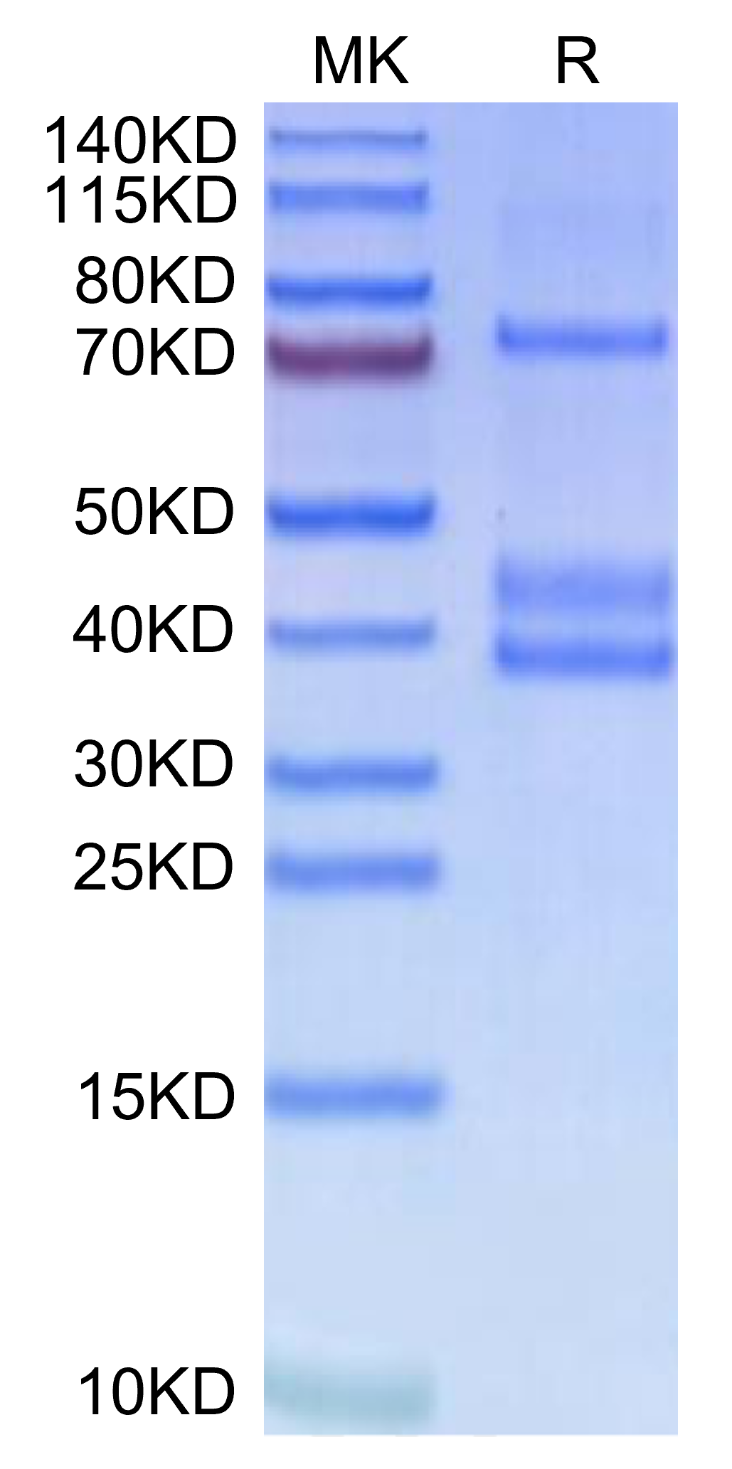 Human MSPR/Ron-Protein (RON-HM101)