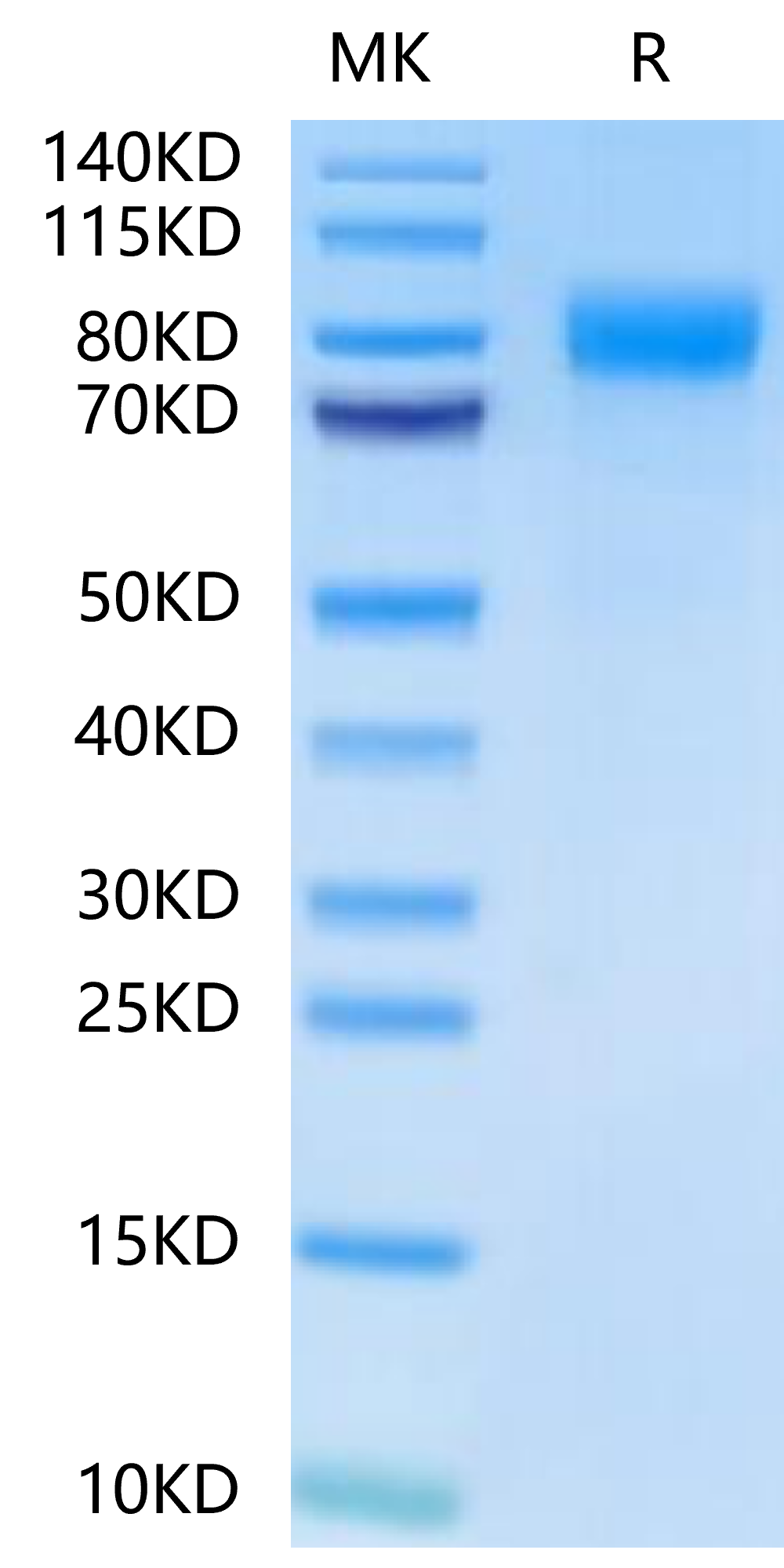 Human BCHE/Butyrylcholinesterase-Protein (BCE-HM101)