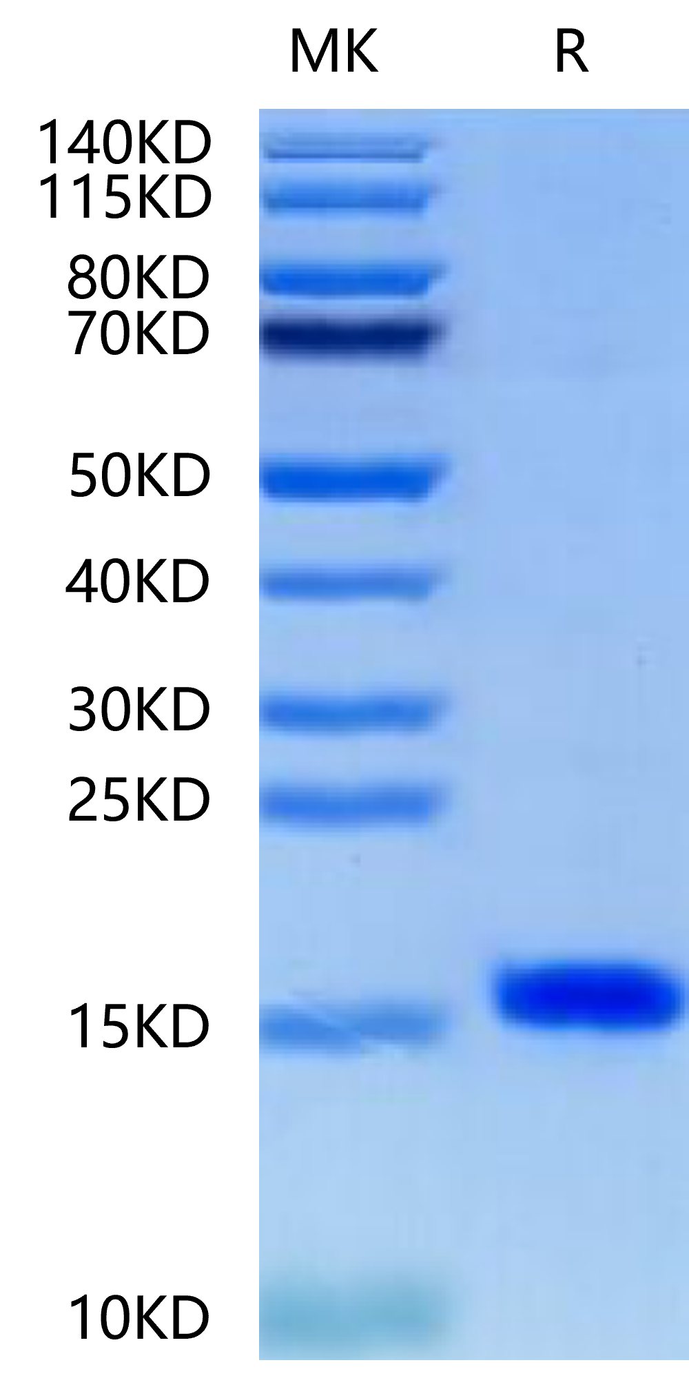 Human/Mouse/Rat BDNF-Protein (BDF-HE001)